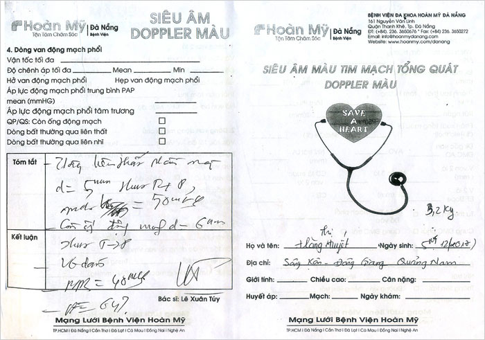 a-lang-thi-tuyet-02.