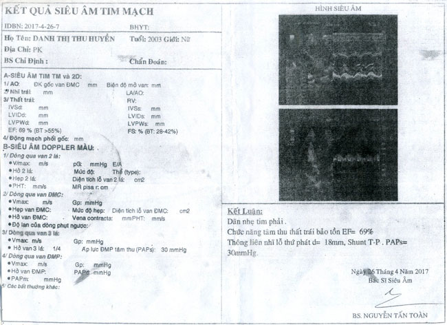 danh-thi-thu-huyen-02a.