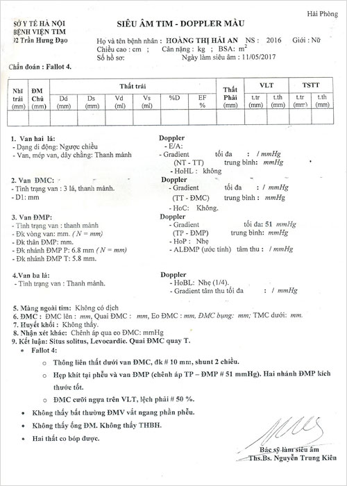 hoang-thi-hai-an-02.