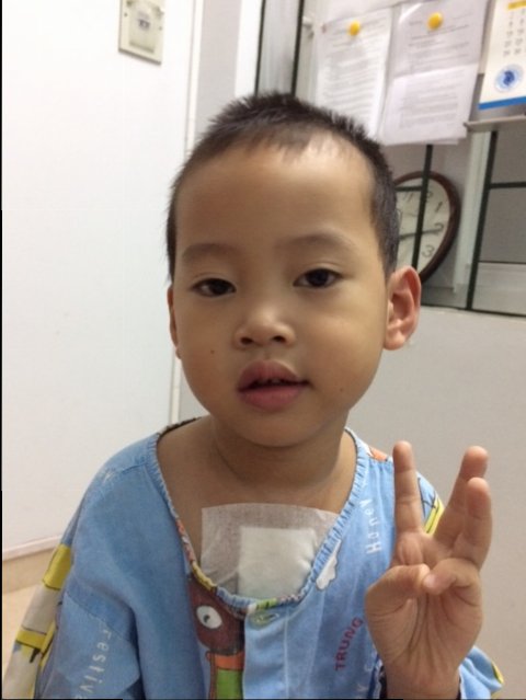 NA. Ng Đình Phúc Nguyên ( mổ 16.6.2017).JPG