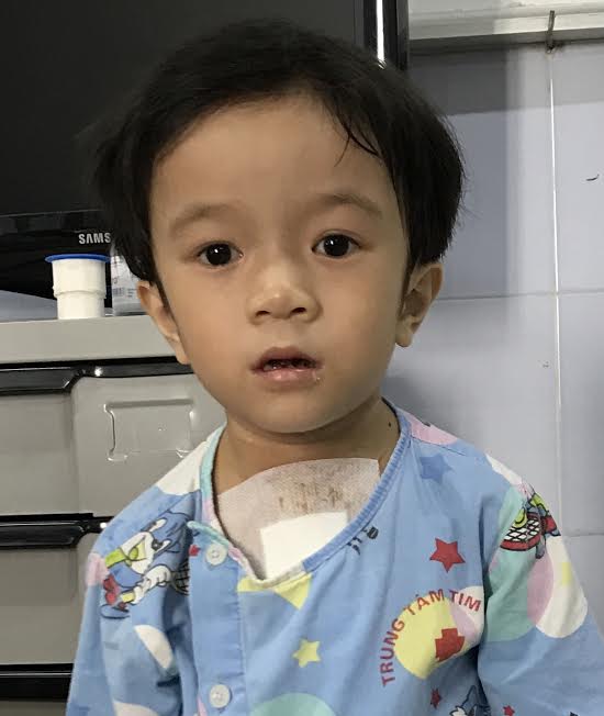 NA. Nguyễn Thị Gia Linh ( mổ 6.2017) (1).