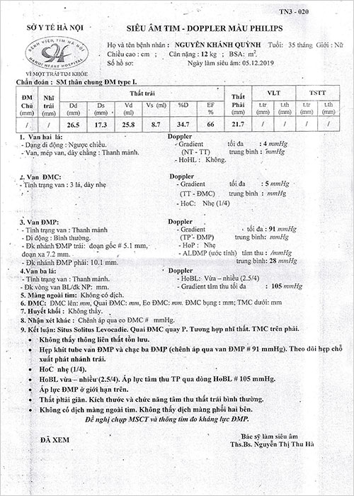 nguyen-khanh-quynh-03.