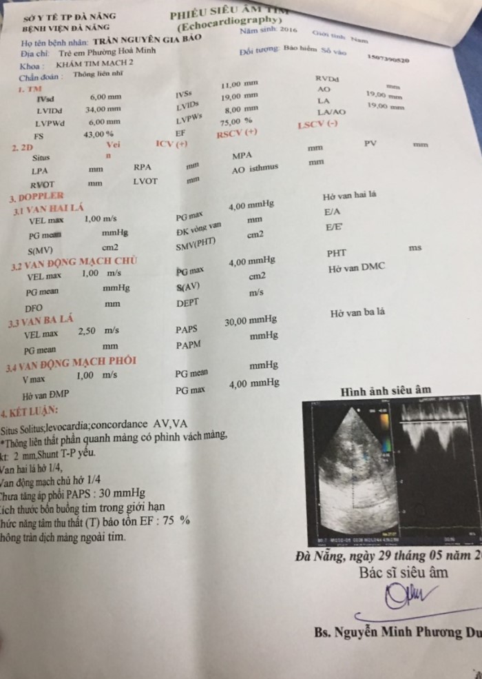 Siêu âm tim Gia Bảo.