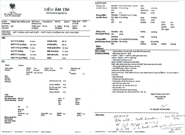 tang-thi-thao-lan-02.