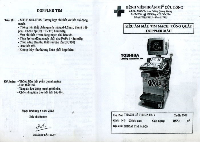 thach-le-thi-da-huy-02.