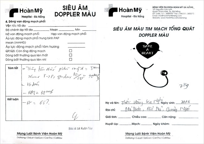 thoi-hoang-gia-nghi-02.