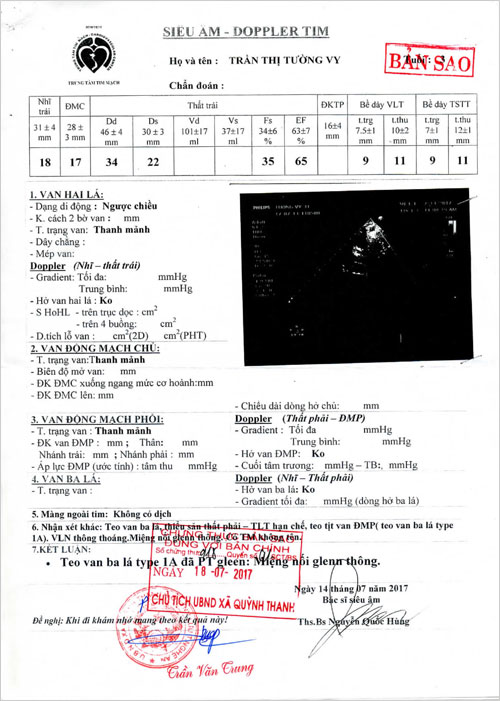 tran-thi-tuong-vy-02.